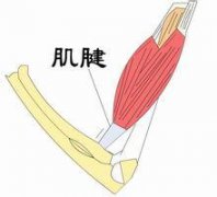 肌腱粘连该怎么办好